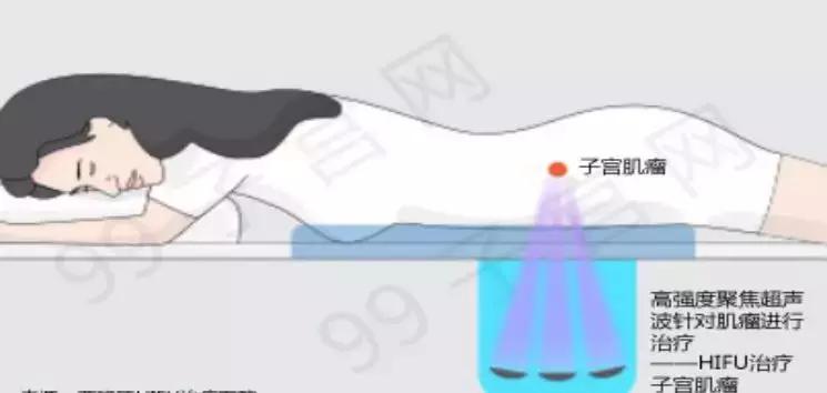 子宫腺肌瘤会成癌吗,中药治疗子宫腺肌症