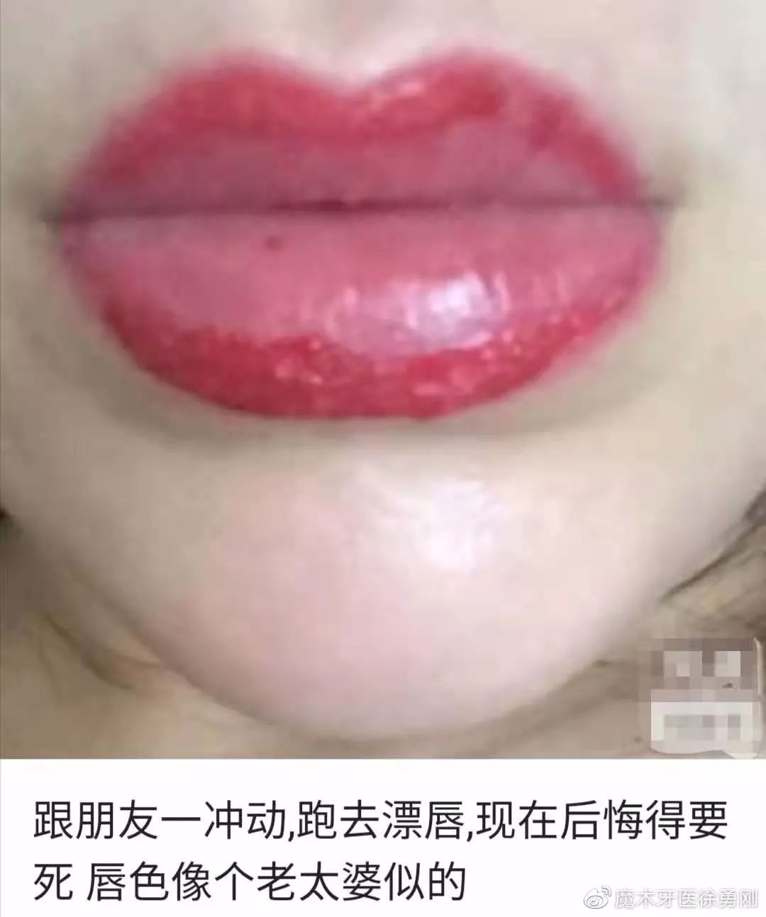 内行人为什么不建议漂唇,作为一名医生一直被人质疑