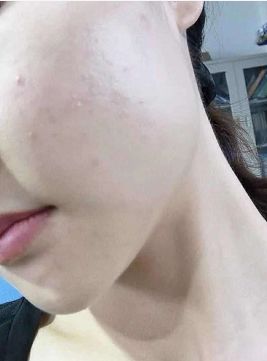 洗面奶十大垃圾国货,十大烂脸洗面奶排行