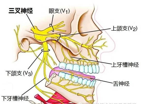 一针消除三叉神经,三叉神经痛一针8000