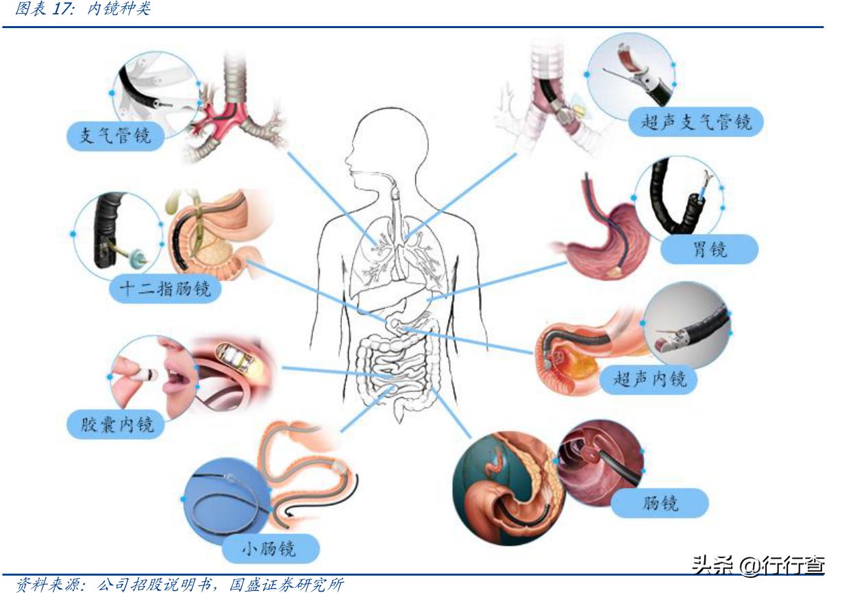 腹腔镜辅助阴式子宫切除手术难点,腹腔镜下广泛子宫切除术手术记录