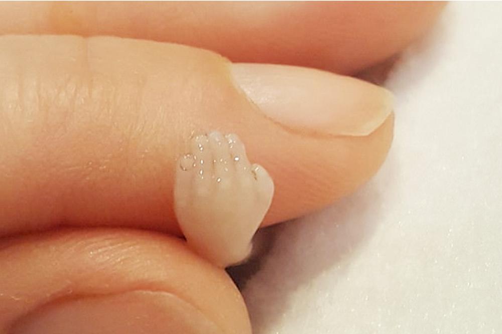 14周引产胎儿是完整的么,母亲分享引产14周胎儿照片