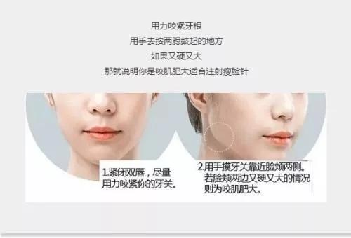 面部咬肌肥大怎么去除,脸部咬肌怎么消除整形