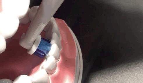 欧乐bd12电动牙刷刷牙正确方法,电动牙刷快速舒适刷牙的必备品