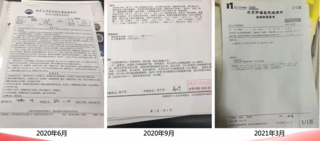 确诊淋巴瘤的最可靠依据是什么,淋巴瘤预后差有治疗必要吗