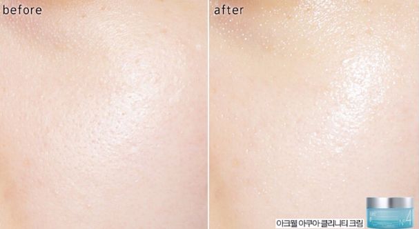 背1万包包去买菜,背十万的包去买菜