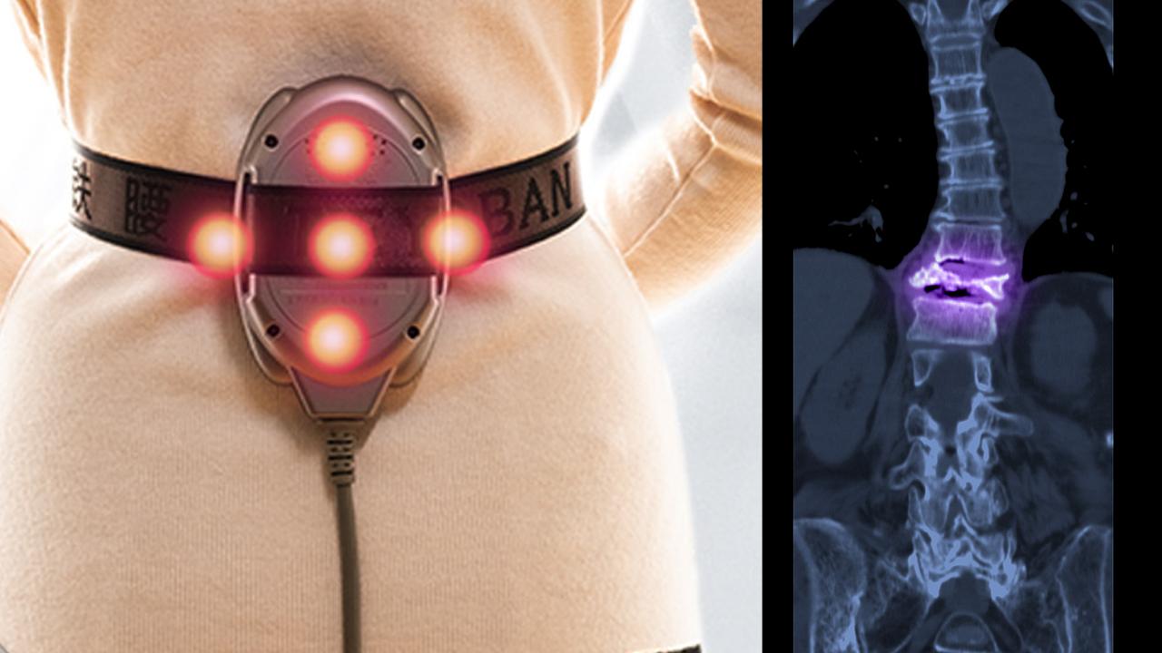 广告铁腰板真的能把腰突治好吗,铁腰板治疗效果图