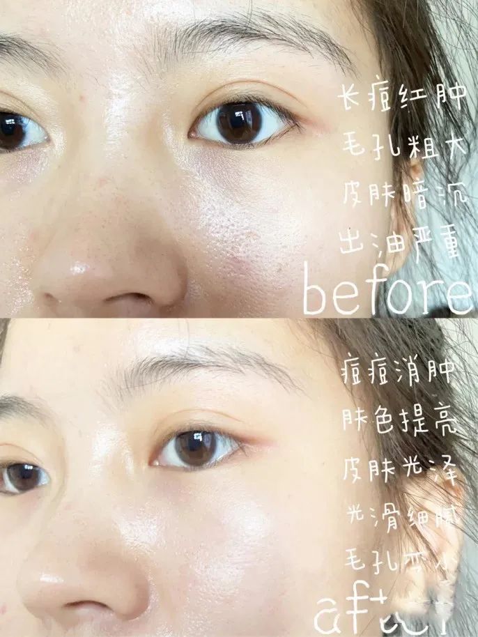 雅诗兰黛小棕瓶精华第六代测评,雅诗兰黛小棕瓶精华第六代第七代