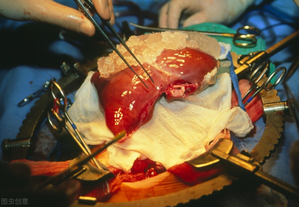 大肠癌的防治健康讲座,结直肠癌肝转移的症状有哪些