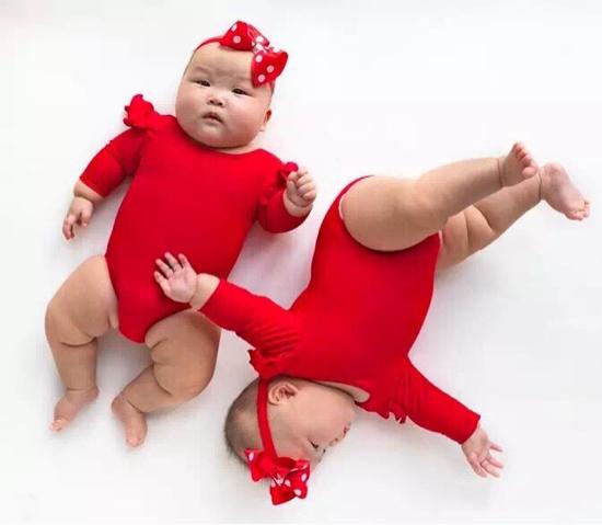 最美胎记，姐姐在胎中被弟弟“吸收”，将B超影像留在弟弟腿上