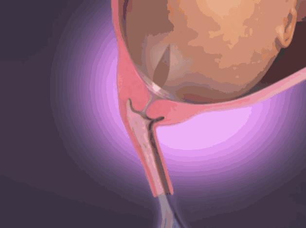 为什么胎儿在母亲身体里叫羊水,包裹胎儿的水为什么叫羊水