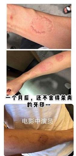 助理伺候明星捏脚,助理伺候明星跪下打伞