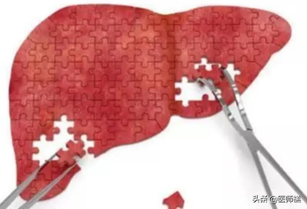 长期吃阿托伐他汀应该注意什么,长期服用阿托伐他汀会有什么后果