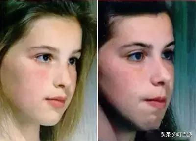 8岁的男孩睡觉打呼是怎么回事,8岁男孩睡觉打呼有鸣音