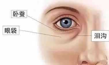 黑眼圈脂肪粒什么原因,眼部有细纹和黑眼圈的最简单方法