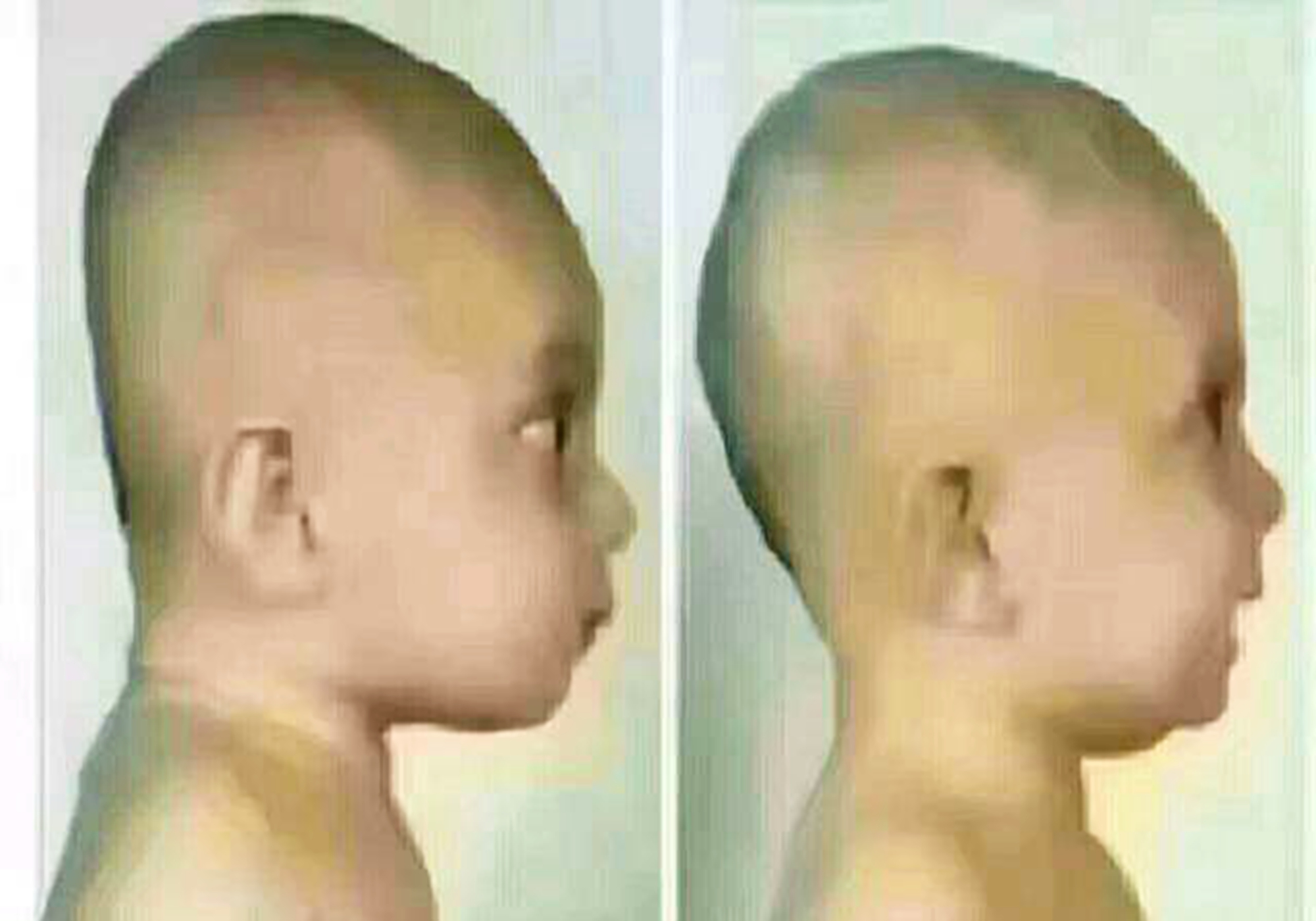 小孩后脑勺特别大是不是很聪明,宝宝后脑勺大睡不下去怎么办