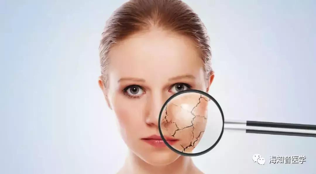 干燥会导致流鼻血喉咙痛吗,嗓子干痛流鼻血怎么办