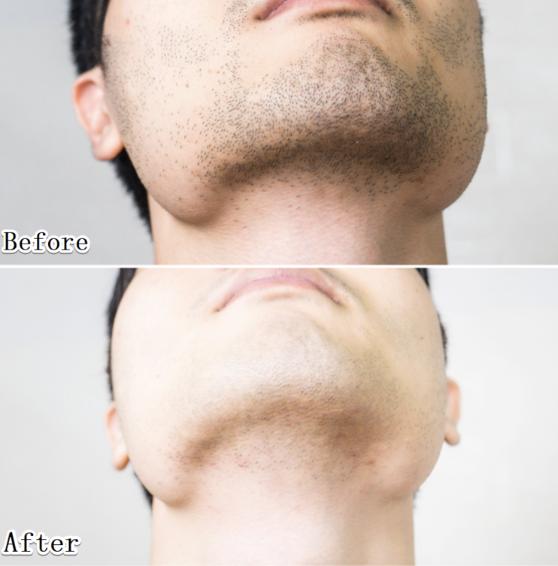 小米有售剃须刀手动,小米特价剃须刀