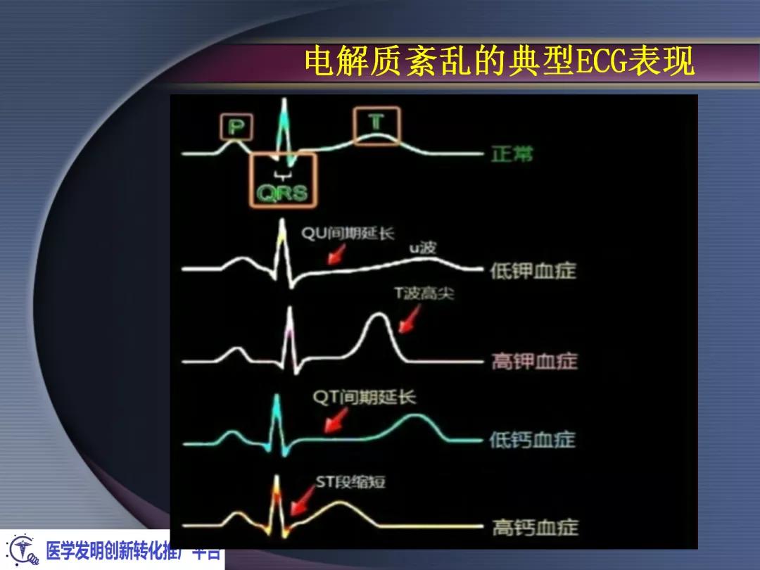 麻醉手术常见心律失常处理,麻醉引起心脏骤停原因