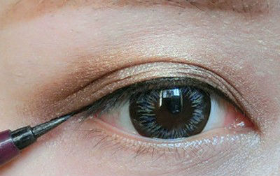 右眼皮下有个疙瘩怎么回事,眼睛下眼皮上长个疙瘩怎么回事