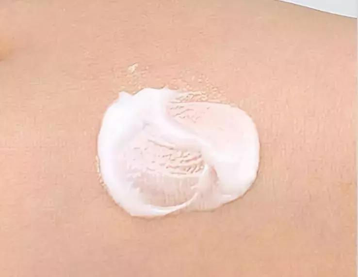 狮王祛痘膏和过氧苯甲酰凝胶,日本狮王祛痘膏可以长期使用吗