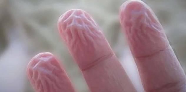 为什么手指泡水会有坑,手指为什么泡水特别容易烂