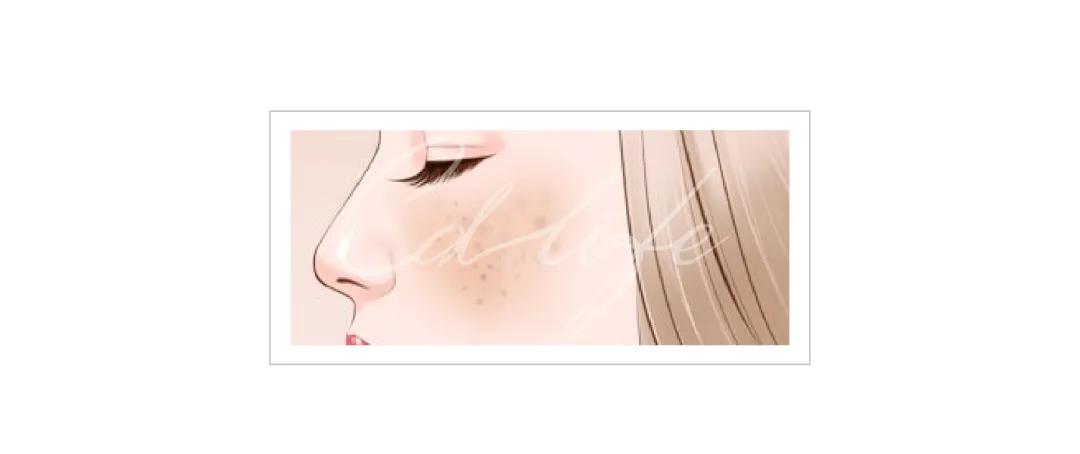 不做黄脸婆教你如何淡化色斑,色斑修复的最佳方法