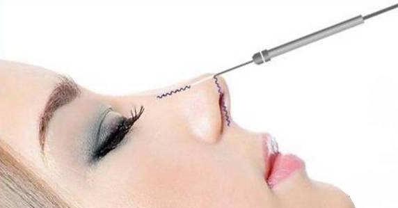 隆鼻方法,隆鼻比较好的方法