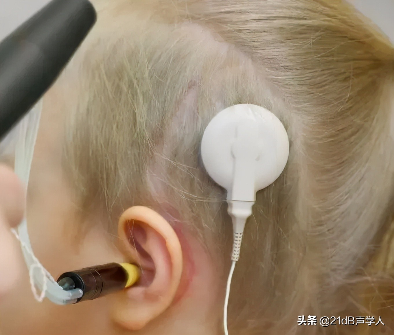 用了人工耳蜗可以听音乐吗,用人工耳蜗可以和正常听力一样吗