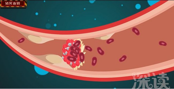 高血压对身体的危害你知道多少,高血压对人体有什么影响和危害