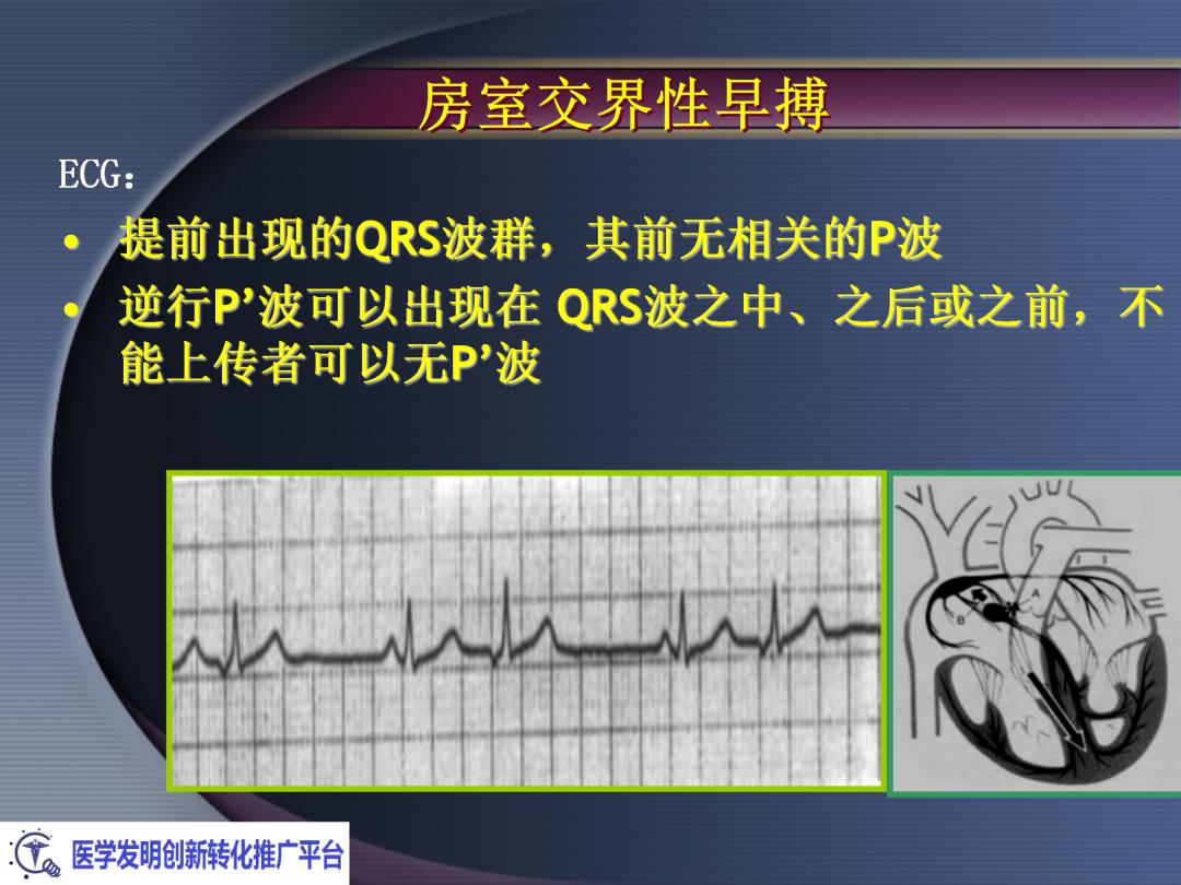 麻醉手术常见心律失常处理,麻醉引起心脏骤停原因