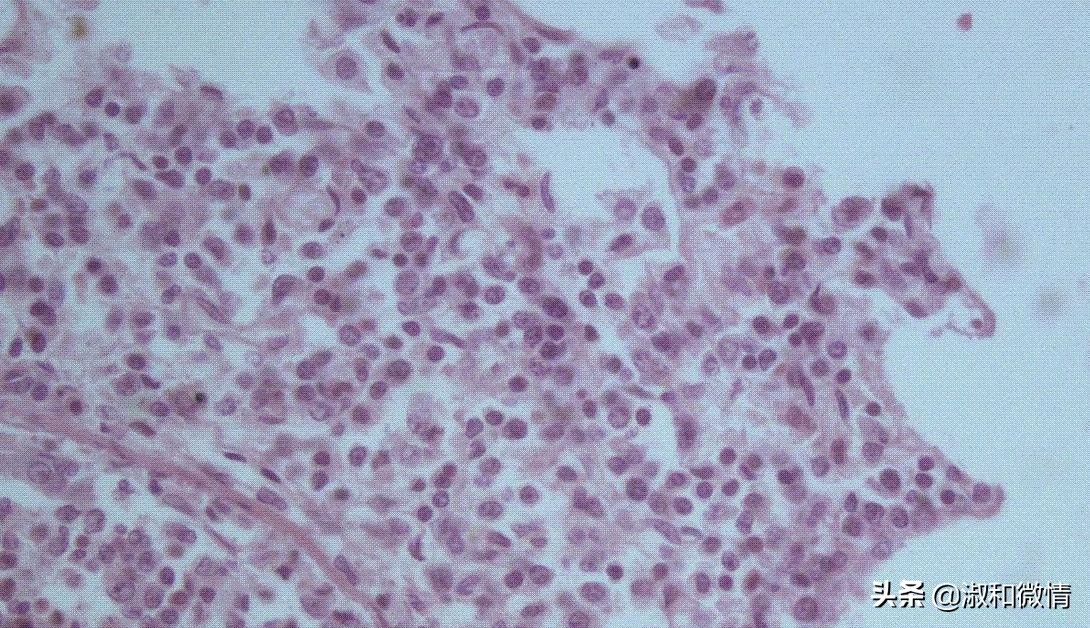 甲硝唑片的说明书用量看不懂,甲硝唑片说明书范文