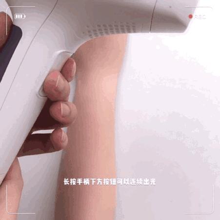 脱毛方法排行榜第一名,目前最好的脱毛技术