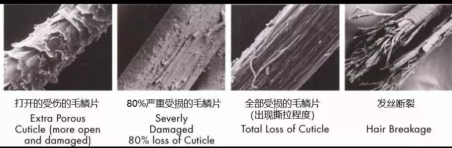 “十男八秃”的日本男人疯抢这瓶小黑钻!让头发不再掉了