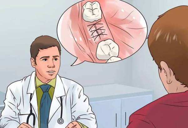 拔智齿真的很可怕吗,拔智齿的风险和后遗症