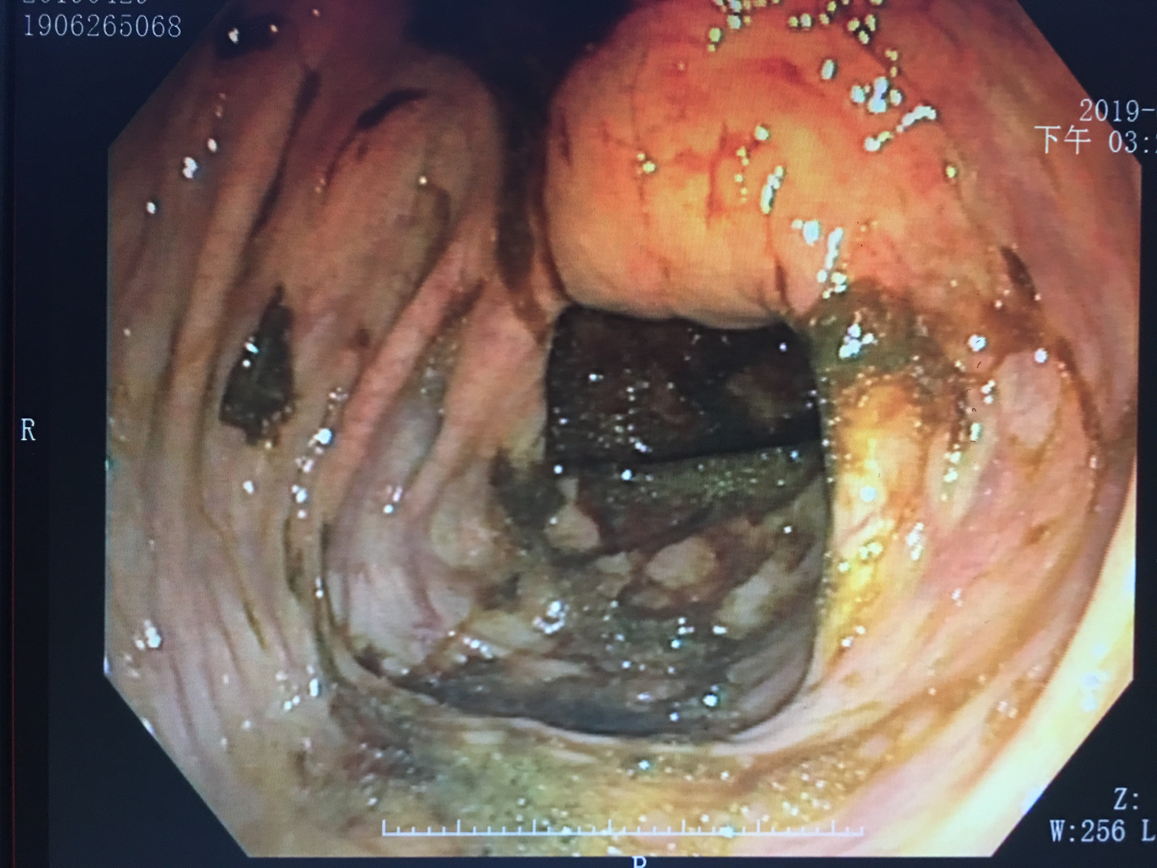 医生说的检查项目我们都必须做吗,医生告诉你应该做哪些检查