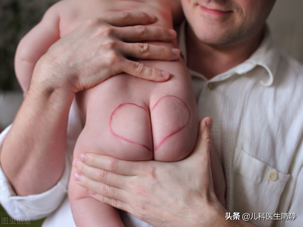 宝宝红屁屁哭闹怎么办,宝宝红屁屁有点破皮了怎么办