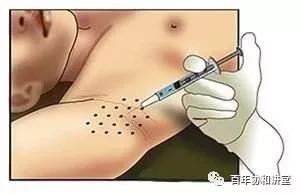 青春期去除腋臭的方法,狐臭人人嫌弃1个妙方有效治狐臭