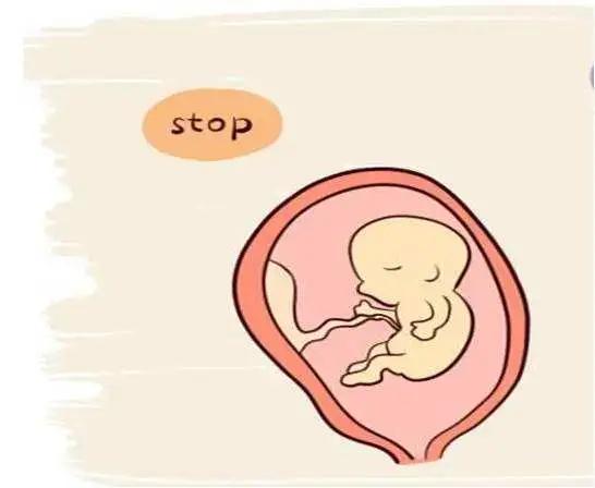 隐匿且沉默的杀手——稽留流产