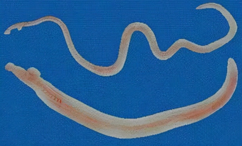 经常肛门痒吃什么药,肛门瘙痒8大原因6招教你远离它