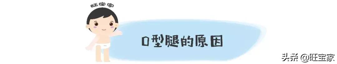 林允儿的o型腿,林允儿的o型腿走路