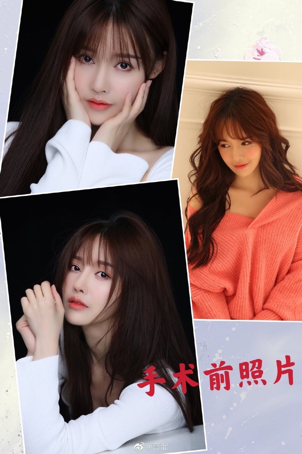 女星高溜整容,演员高溜整容失败欲轻生