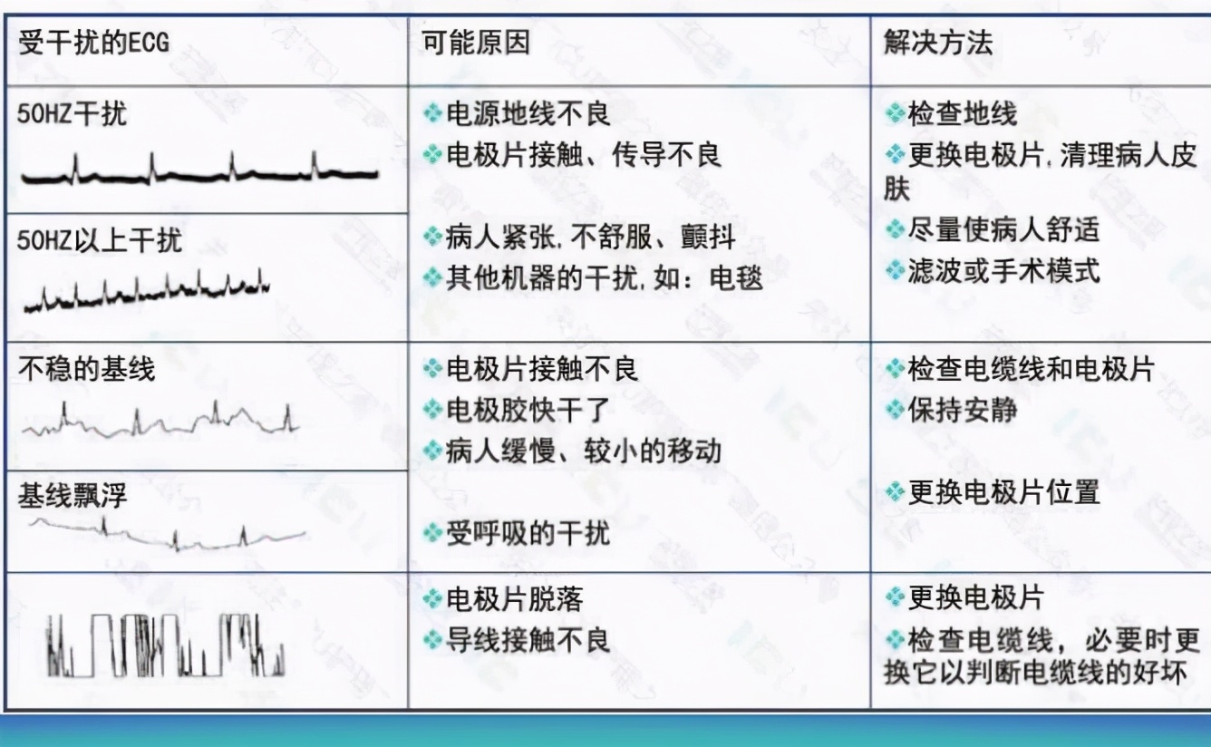 心电监护使用的收费标准,心电监护使用年限