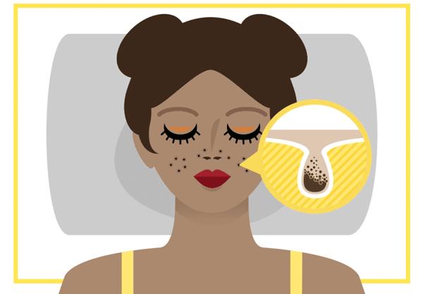 市场上的淡斑霜能有效的祛斑,怎样淡斑祛斑最有效