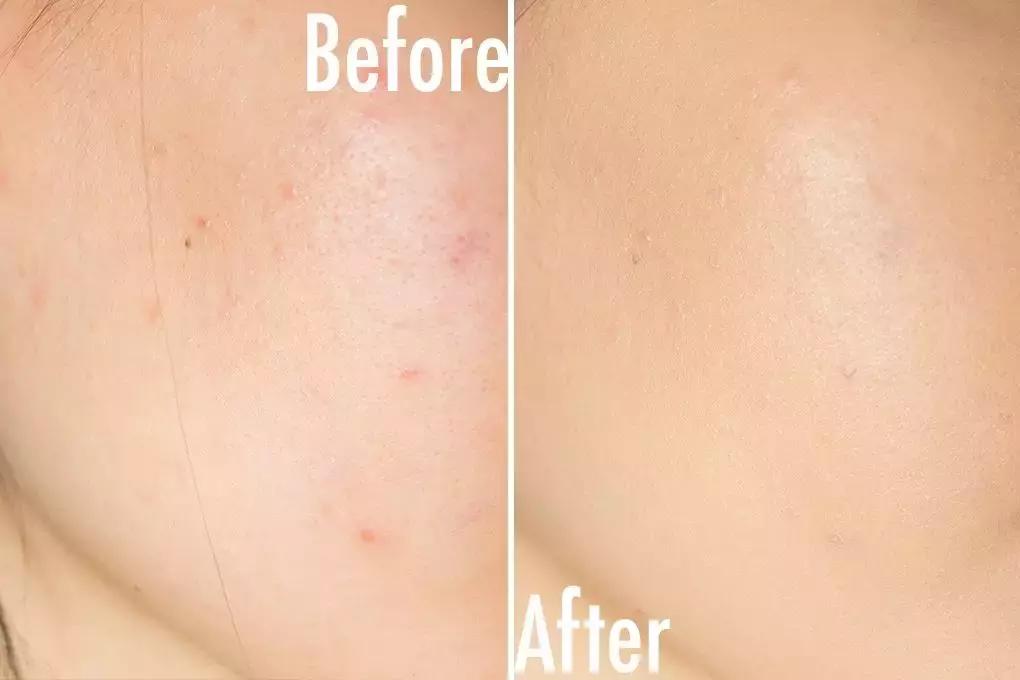 冬天十大遮瑕最好平民粉底液,冬日干皮遮瑕效果好的大牌粉底