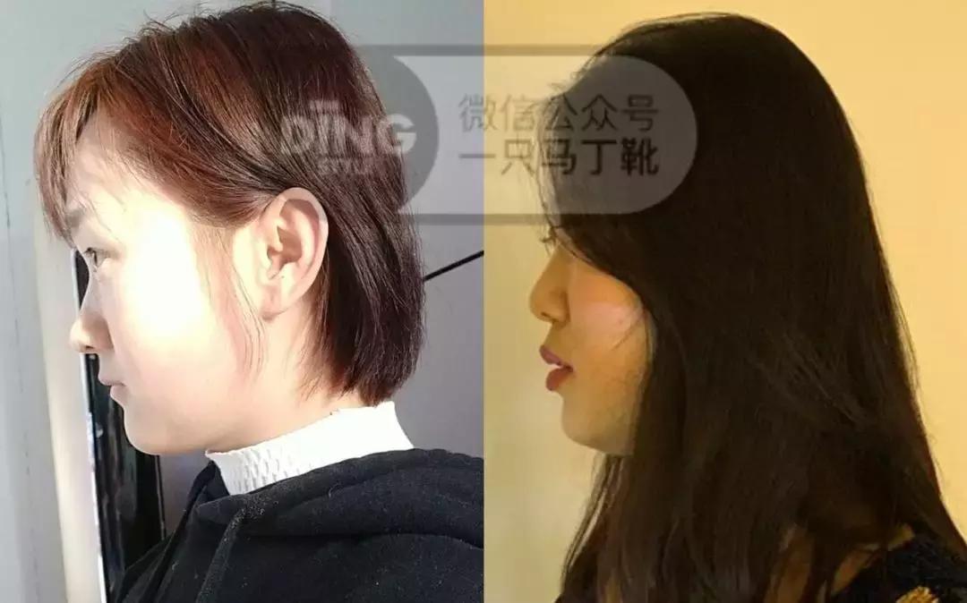 修饰扁头头型的发型,头型不好扁头适合什么发型