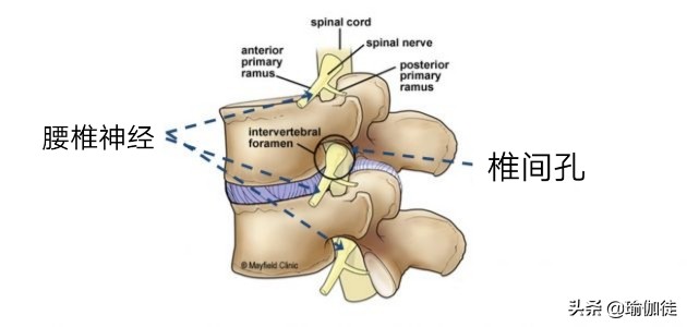 怎么练瑜伽才能缓解腰椎间盘突出,腰椎间盘突出怎么练瑜伽恢复