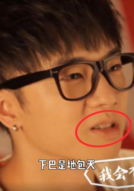 美妆网红晒华晨宇变脸过程质疑其做了3项整容手术，真的不怕被告