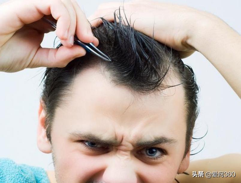 头发白严重怎么补救,头发白是什么原因怎么改善