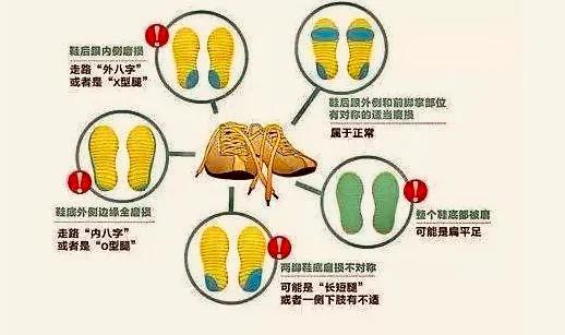 关注“跑偏”的鞋子，提示你的健康问题！